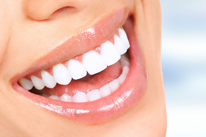 Cosmetic Dentistry in Woodland Hills